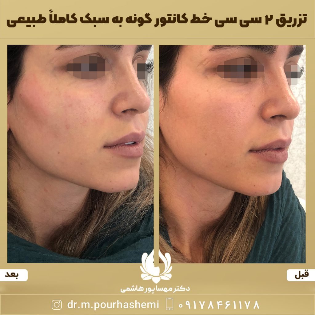دکتر مهسا پورهاشمی